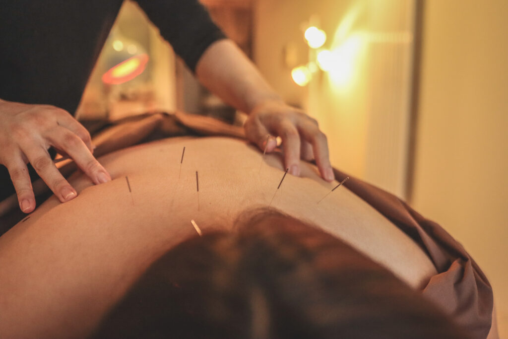 Acupuncture for mental health in dimly lit room - amend treatment