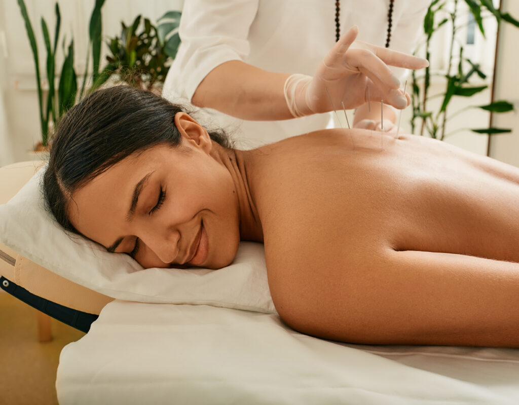 Woman receiving acupuncture therapy treatment - Amend Treatment